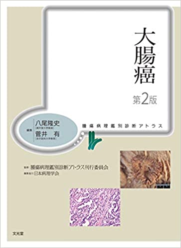 免税店サイト 【中古】 胆道癌・膵癌 (腫瘍病理鑑別診断アトラス ...